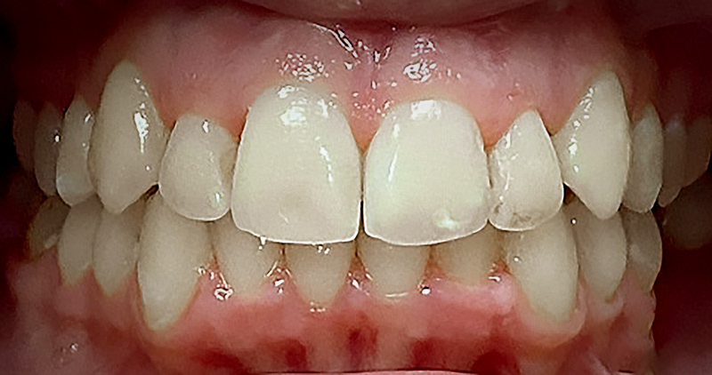 Before image