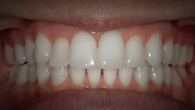 After image