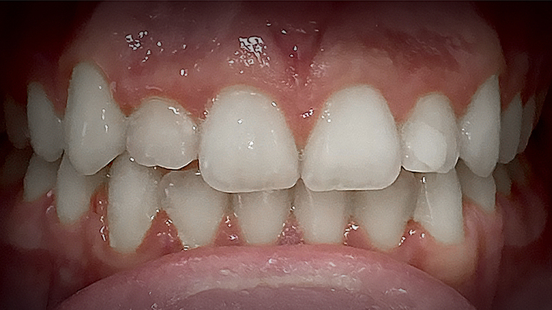 After image