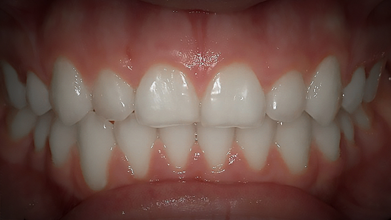 After image