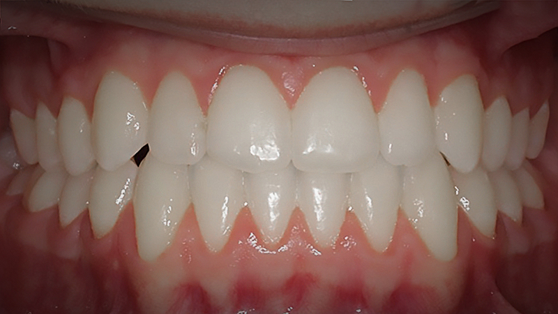 After image