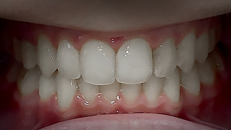 After image