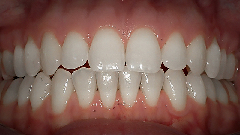 After image