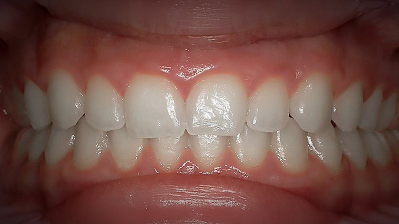 After image