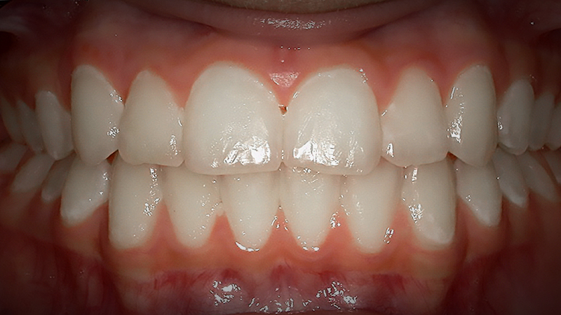 After image