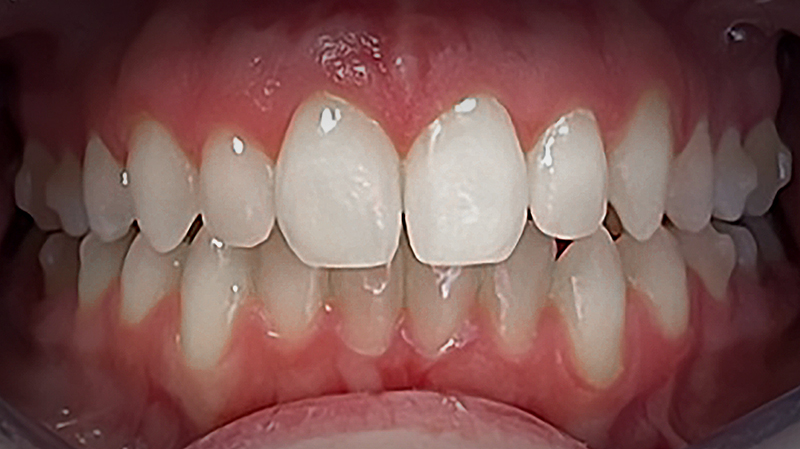 After image