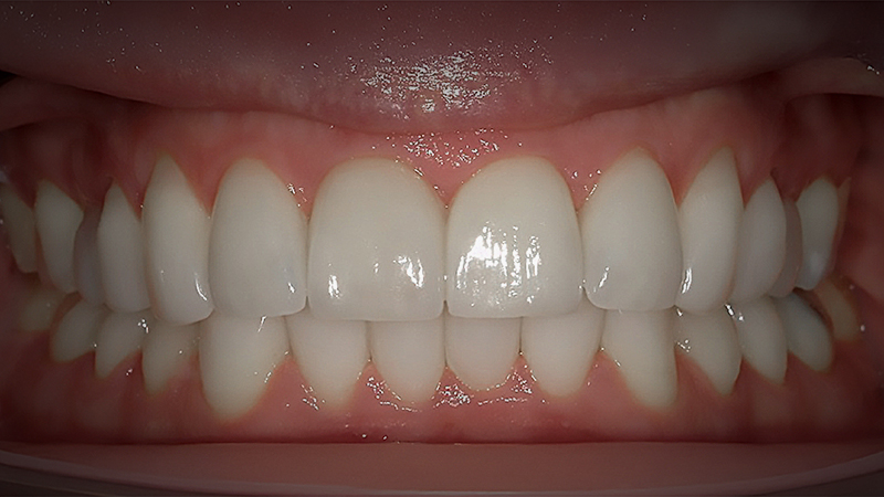After image
