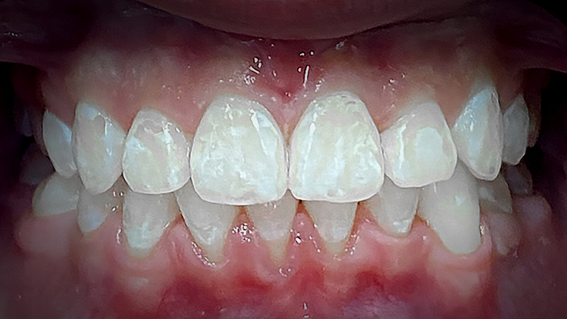 After image