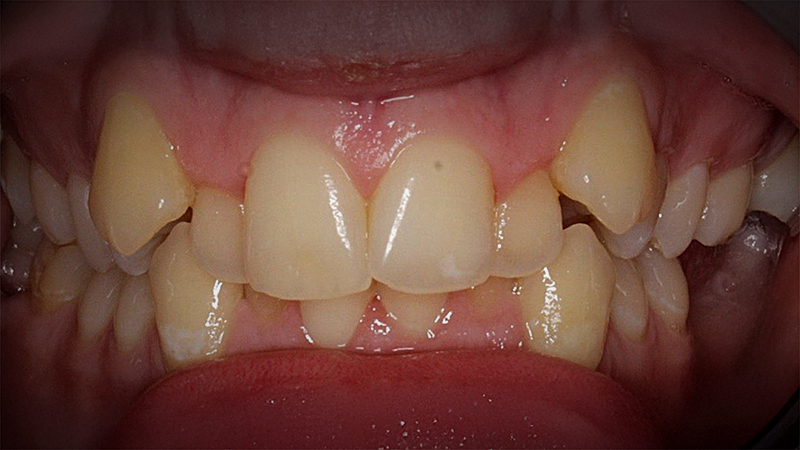 After image