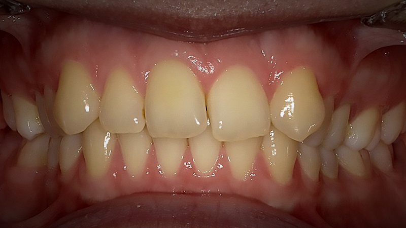Before image