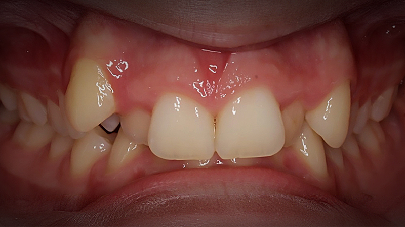 Before image