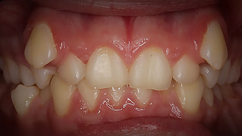 Before image