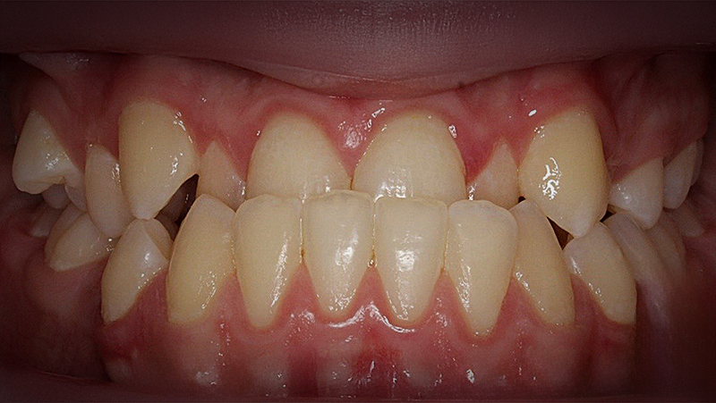 Before image