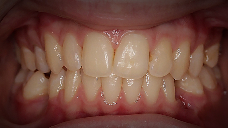 Before image