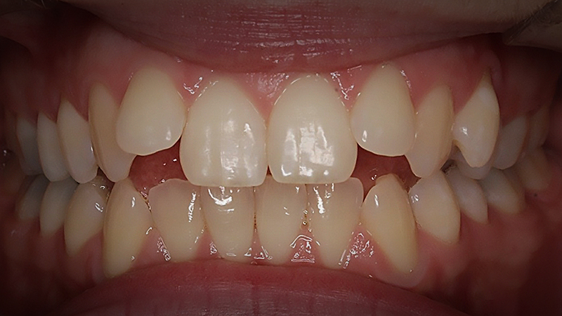 Before image