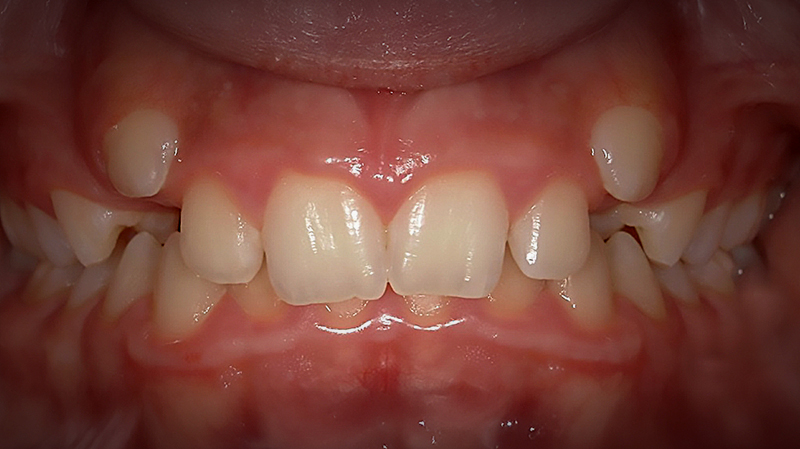 Before image