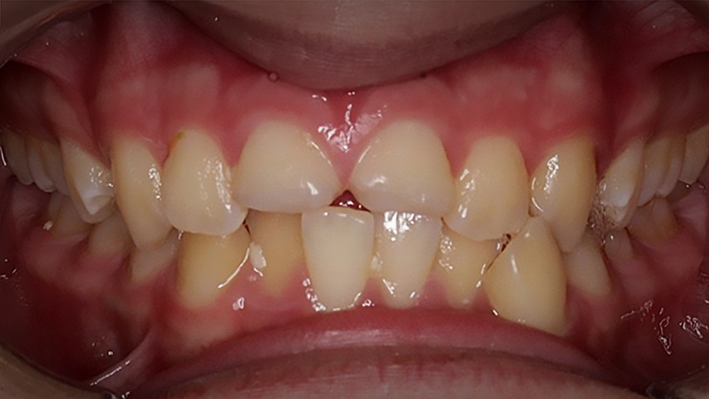 Before image