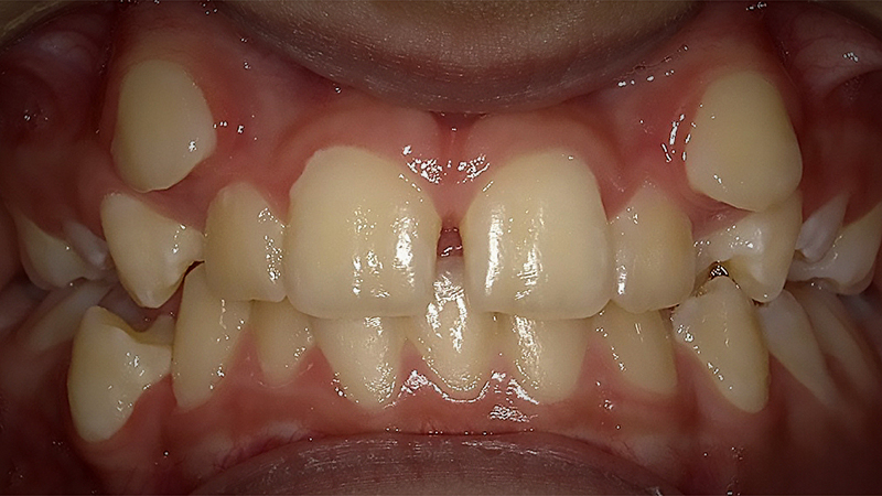 Before image