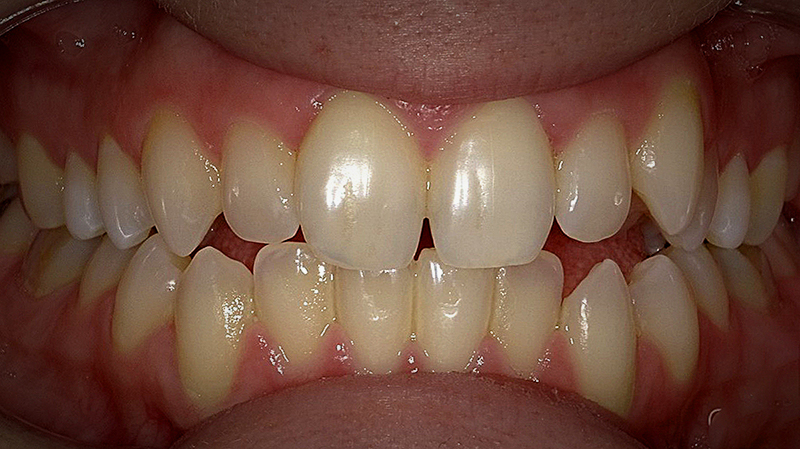 Before image