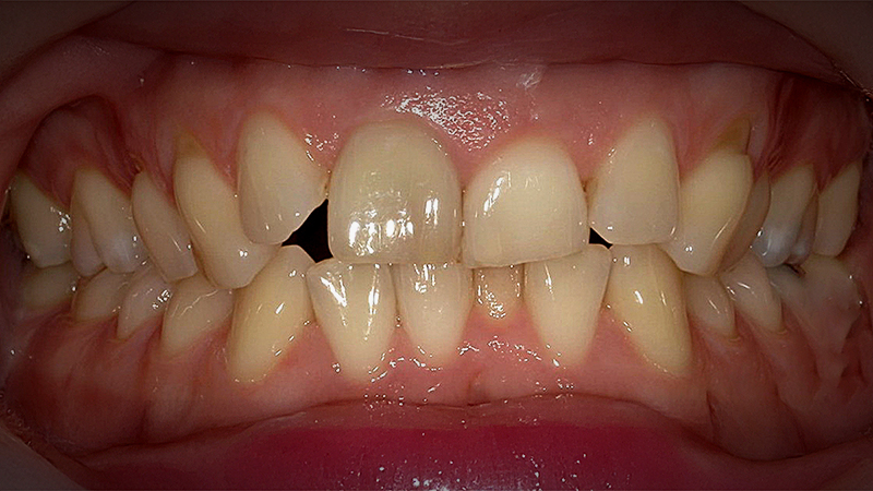 Before image