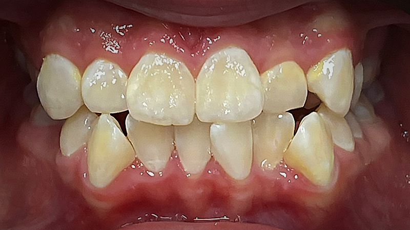 Before image