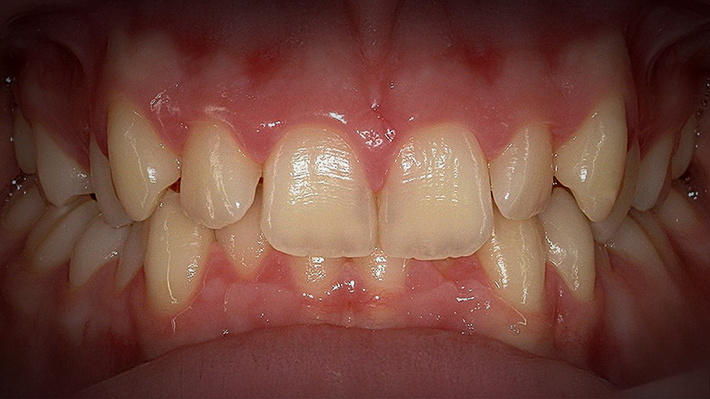 Before image